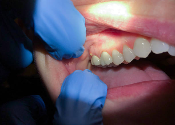 Best Emergency Dentist for Special Needs Patients in Westmorland, CA