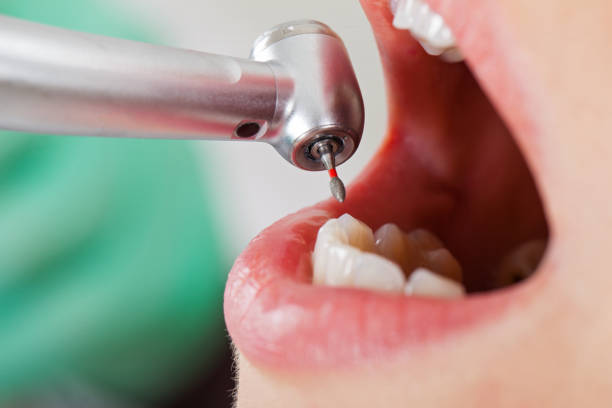 Best Weekend Emergency Dentist in Westmorland, CA